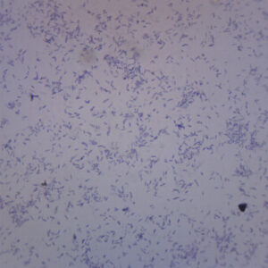 Clostridium Botulinum - Prepared Microscope Slide - 75x25mm