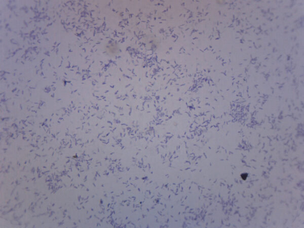 Clostridium Botulinum - Prepared Microscope Slide - 75x25mm