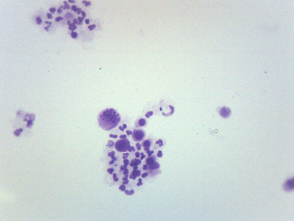 Female Chromosome Smear, Human - Prepared Microscope Slide - 75x25mm