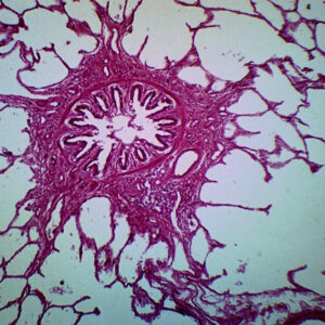 Lung Of Cat - Prepared Microscope Slide - 75x25mm