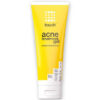 Touch Acne Treatment Gel - Benzoyl Peroxide 2.5% 227g