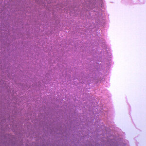 Lymph Node Section - Prepared Microscope Slide - 75x25mm