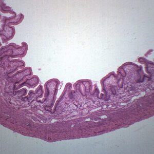 Gallbladder - Prepared Microscope Slide - 75x25mm