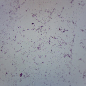 Vibrio Cholerae Smear - Prepared Microscope Slide - 75x25mm