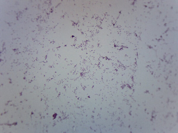 Vibrio Cholerae Smear - Prepared Microscope Slide - 75x25mm