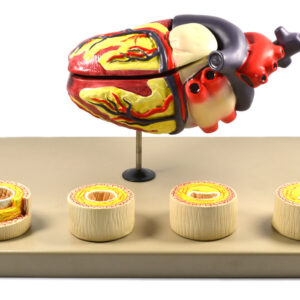 Eisco Labs Model of Human Heart Conditions Pathology; Larger than life size (10"); Artery Cross sections 2.5" in diameter