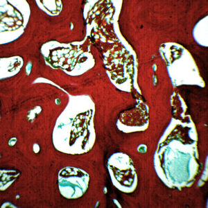 Spongy Bone Section (Mammal) - Prepared Microscope Slide - 75x25mm