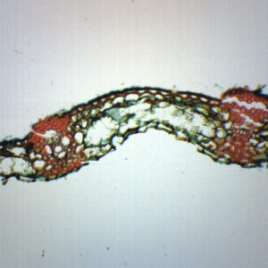 Puccina Graminis Uredina Section - Prepared Microscope Slide - 75x25mm