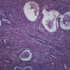 Human Prostate Section - Prepared Microscope Slide - 75x25mm