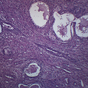 Human Prostate Section - Prepared Microscope Slide - 75x25mm
