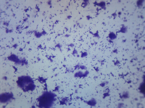 Human Mouth Bacteria - Wholemount - Prepared Microscope Slide - 75x25mm
