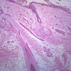 Hairy Skin Section - Prepared Microscope Slide - 75x25mm