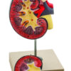 Eisco Life-Size Human Kidney with Adrenal Gland Model 2 Parts