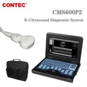 buy CMS600P2  Portable Laptop Machine Digital Ultrasound Scanner,3.5 Convex Probe  CONTEC best price in nigeria from mybigpgarmacy.com