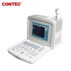 buy CONTEC CMS600B-3 Portable Full Digital Ultrasound Scanner Machine 3.5 Convex Probe best price in nigeria from Allschoolabs.com