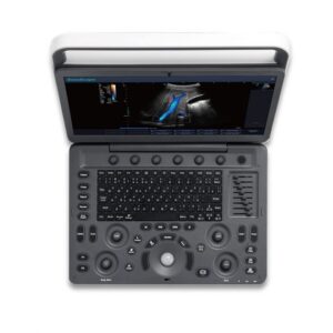Sonoscape E2 Ultrasound Machine