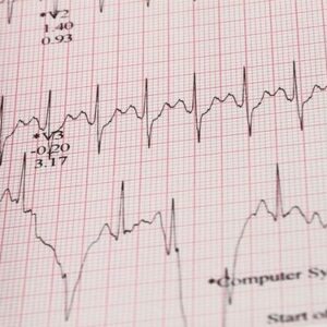 Nihon Kohden Electrocardiograph 2350 Paper