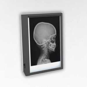 Single X-Ray Viewing Box
