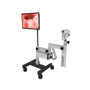 Ecleris HD Digital Video Colposcope