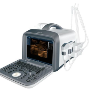WHITE BLACK ULTRASOUND WITH CONVEX PROBE 6602 (SHIPPED FROM ABROAD)