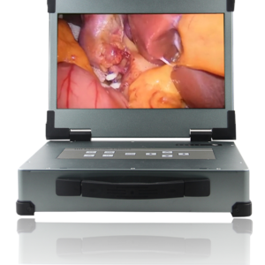 HD 330 Endoscopic Camera