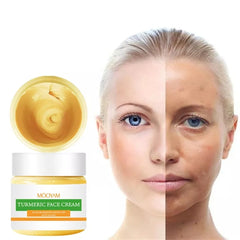 Turmeric Face Cream | Turmeric Cream for Anti-aging, Dark Spots and Acne