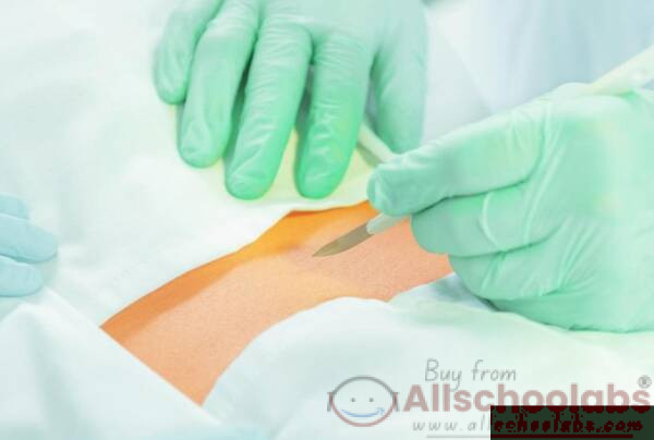 Incision and Drainage Trays
