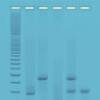 DNA Fingerprinting - Using PCR