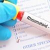 Rheumatoid Factor Test Kit