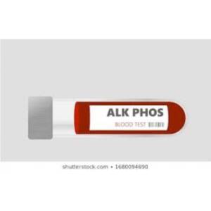Alkaline Phos (Dgke) 2*3 ml