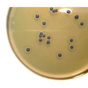 Baird Parker Agar (500GM)