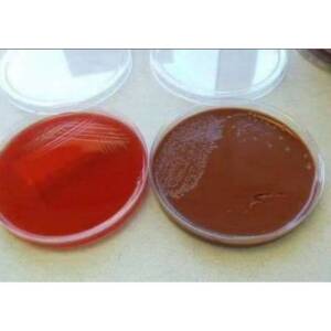 Blood Agar // Chocolate Agar