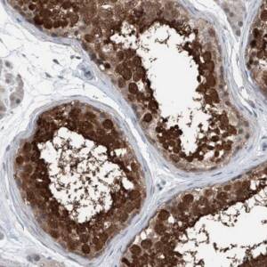 Anti-HSPA6 antibody produced in rabbit , 100 ?L
