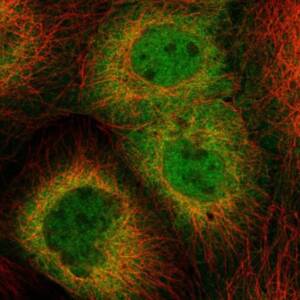 Anti-HSPH1 antibody produced in rabbit , 25 ?L