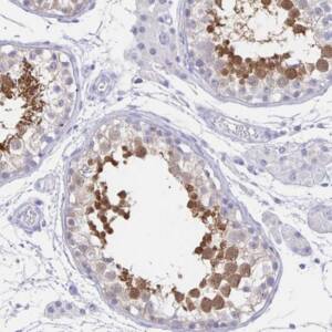Anti-HSPA4L antibody produced in rabbit , 100 ?L