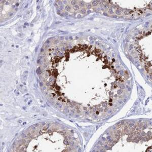 Anti-HSPA1L antibody produced in rabbit ,25UL