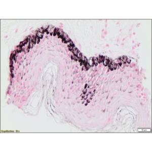 Fontana-Masson Stain Kit