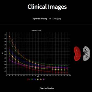 Anke S800 256-Slice CT Scanner