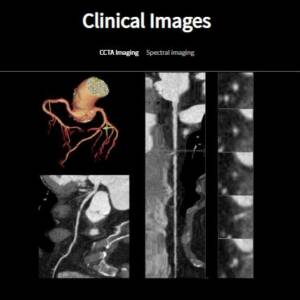 Anke Anatom Precision 128-Slice CT Scanner
