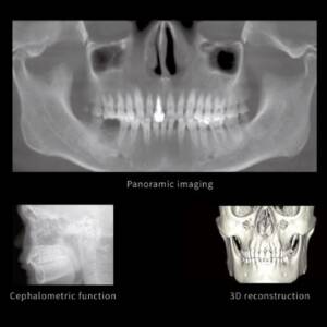 Anke Dentom CBCT