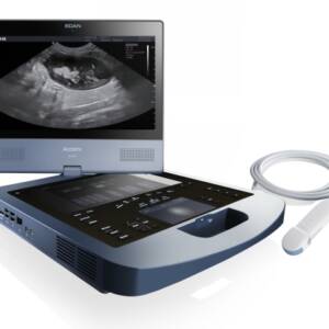 Acclarix AX8 Diagnostic Ultrasound System