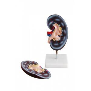 Model Human Kidney