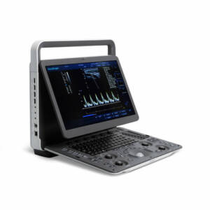 Sonoscape E1 Ultrasound Machine