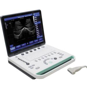 Portable Ultrasound Machine