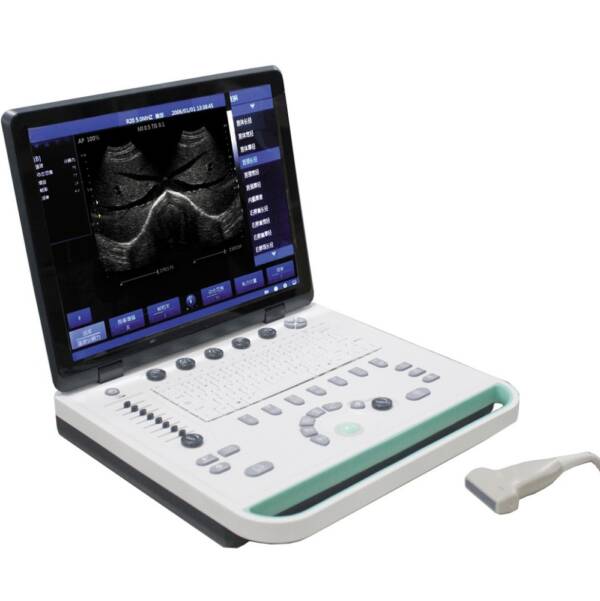 Portable Ultrasound Machine