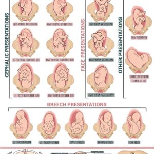 POSTER, FOETAL PRESENTATIONS 30x42cm