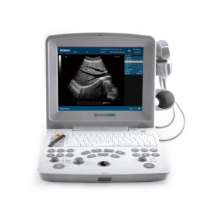 Edan DUS 60 Digital Ultrasound