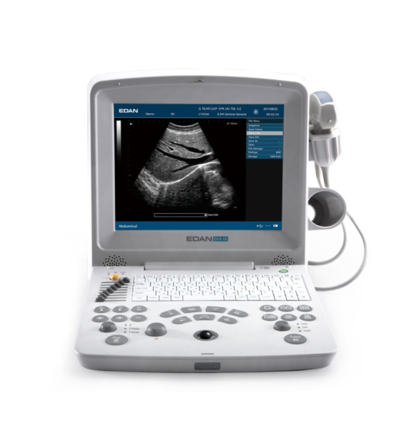 Edan DUS 60 Digital Ultrasound