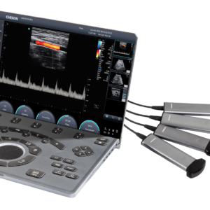 The New SonoAir30 Laptop-Based Ultrasound System