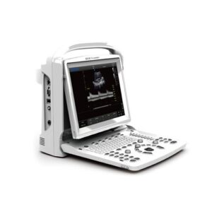 CHISON ECO3 EXPERT |Black and white ultrasound